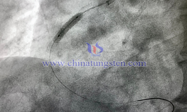 導絲用細金屬鎢絲